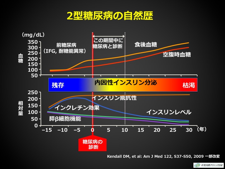 2型糖尿病の自然歴