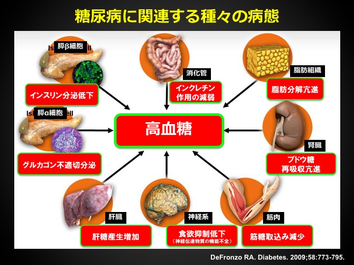 糖尿病に関連する病態の図