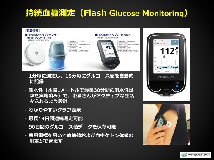 持続血糖測定について
